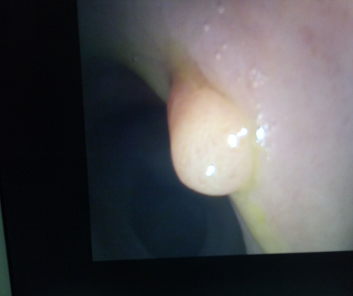 710808F7-8EAC-4236-9135-79D1EE7E8219.png